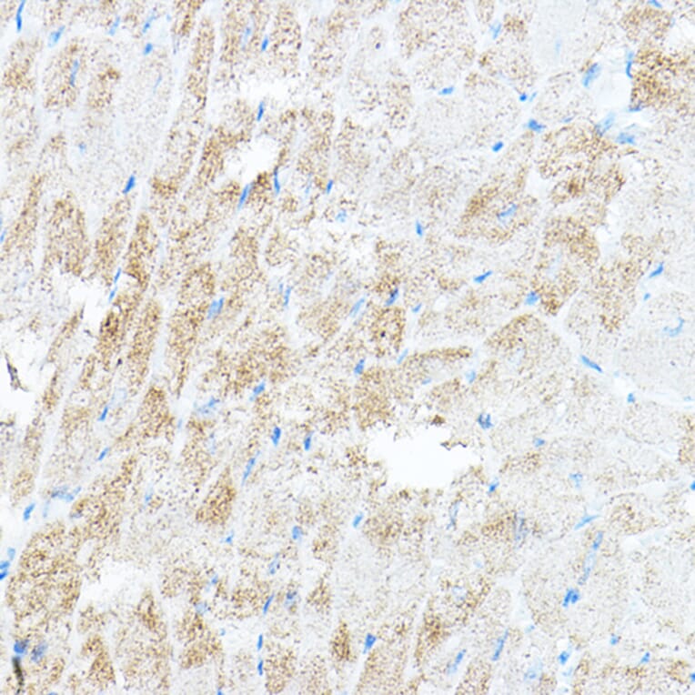 Immunohistochemistry - Anti-PDK4 Antibody (A90016) - Antibodies.com