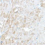 Immunohistochemistry - Anti-PDK4 Antibody (A90016) - Antibodies.com