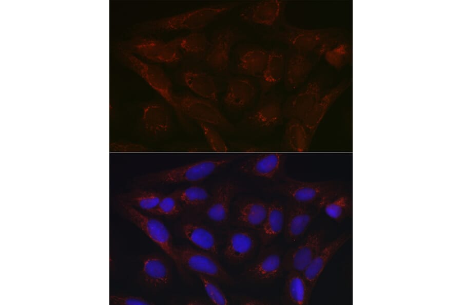 Immunofluorescence - Anti-PDK4 Antibody (A90016) - Antibodies.com