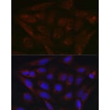 Immunofluorescence - Anti-PDK4 Antibody (A90016) - Antibodies.com