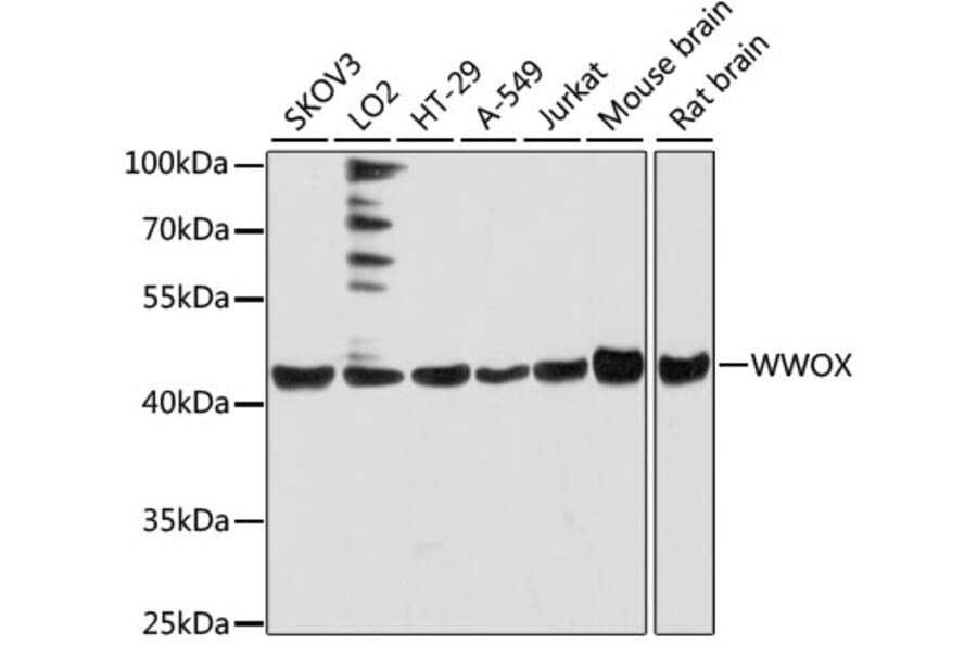 Western Blot - Anti-WWOX Antibody (A90017) - Antibodies.com