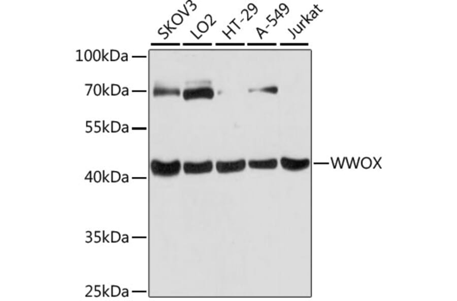 Western Blot - Anti-WWOX Antibody (A90018) - Antibodies.com