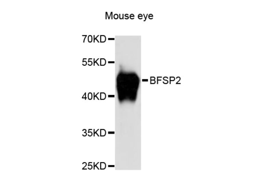 Western Blot - Anti-BFSP2 Antibody (A13055) - Antibodies.com