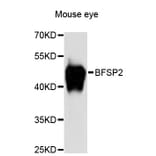 Western Blot - Anti-BFSP2 Antibody (A13055) - Antibodies.com