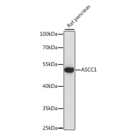 Western Blot - Anti-ASCC1 Antibody (A90020) - Antibodies.com