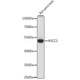 Western Blot - Anti-ASCC1 Antibody (A90020) - Antibodies.com