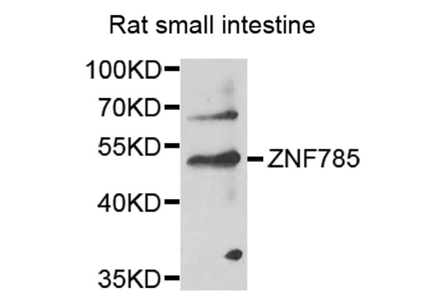 Western Blot - Anti-ZNF785 Antibody (A14161) - Antibodies.com