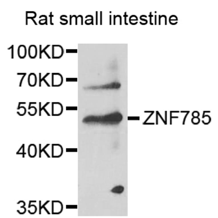 Western Blot - Anti-ZNF785 Antibody (A14161) - Antibodies.com
