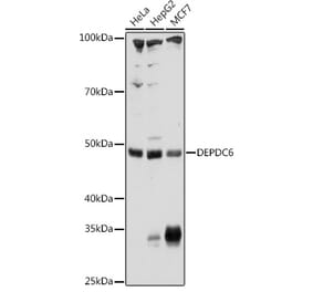 Western Blot - Anti-Deptor Antibody (A90023) - Antibodies.com