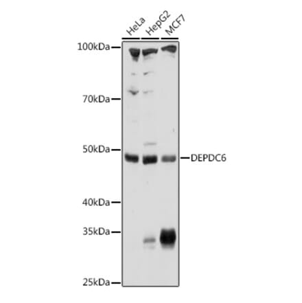 Western Blot - Anti-Deptor Antibody (A90023) - Antibodies.com