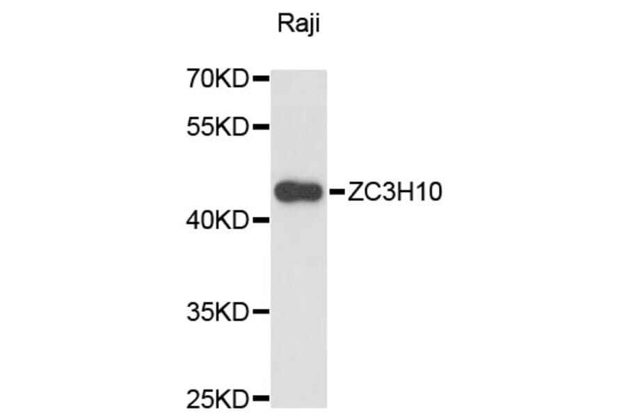 Western Blot - Anti-ZC3H10 Antibody (A13753) - Antibodies.com