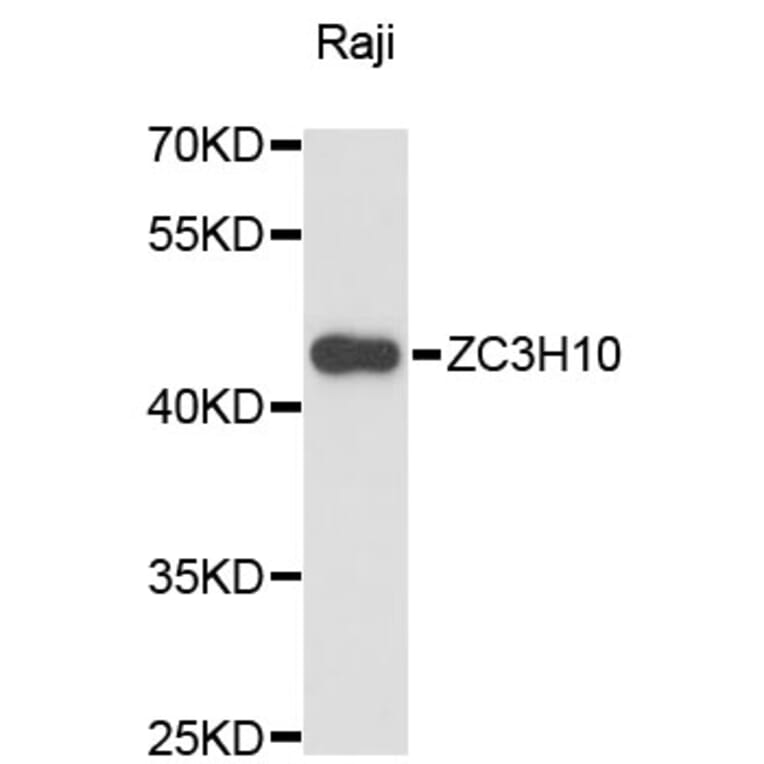 Western Blot - Anti-ZC3H10 Antibody (A13753) - Antibodies.com