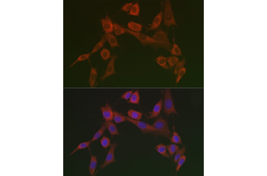 Immunofluorescence - Anti-HSP47 Antibody (A90026) - Antibodies.com