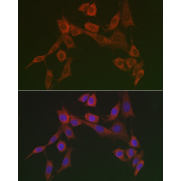 Immunofluorescence - Anti-HSP47 Antibody (A90026) - Antibodies.com