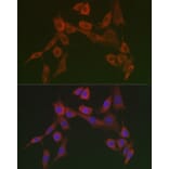 Immunofluorescence - Anti-HSP47 Antibody (A90026) - Antibodies.com
