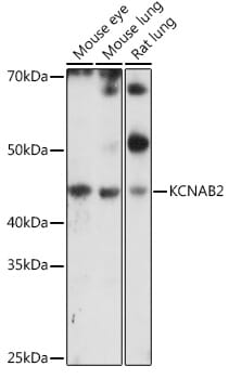 Western blot analysis of extracts of various cell lines, using Anti-KCNAB2 Antibody (A16224) at 1:1,000 dilution.
Secondary antibody: Goat Anti-Rabbit IgG (H+L) (HRP) (AS014) at 1:10,000 dilution.
Lysates / proteins: 25µg per lane.
Blocking buffer: 3% non-fat dry milk in TBST.
Detection: ECL Enhanced Kit (RM00021).
Exposure time: 90s.