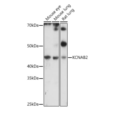 Western Blot - Anti-KCNAB2 Antibody (A90027) - Antibodies.com