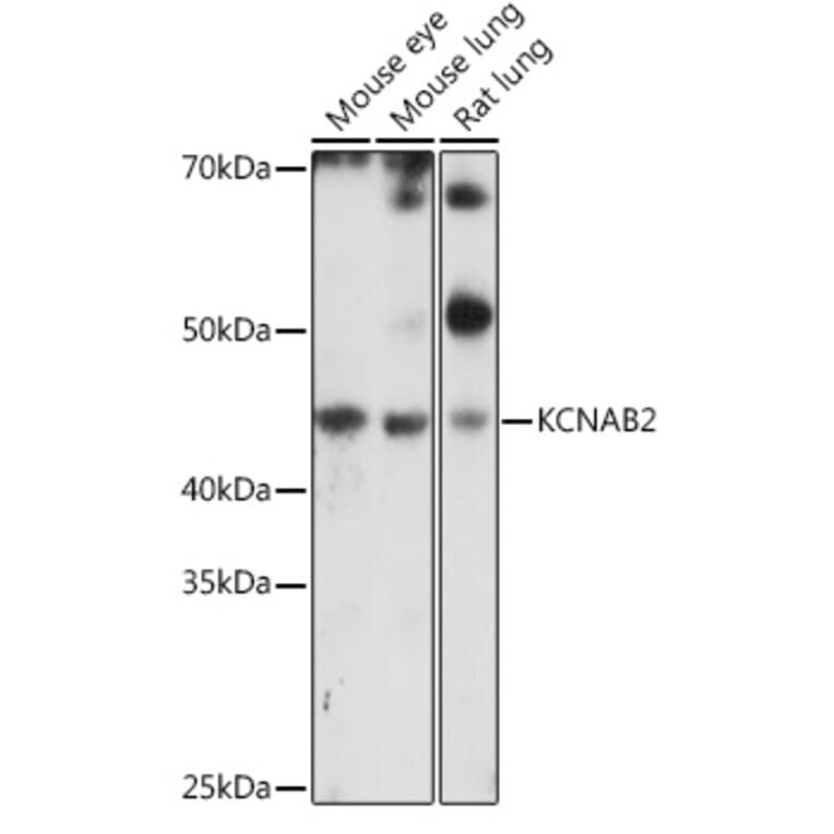 Western Blot - Anti-KCNAB2 Antibody (A90027) - Antibodies.com