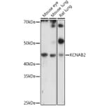 Western Blot - Anti-KCNAB2 Antibody (A90027) - Antibodies.com