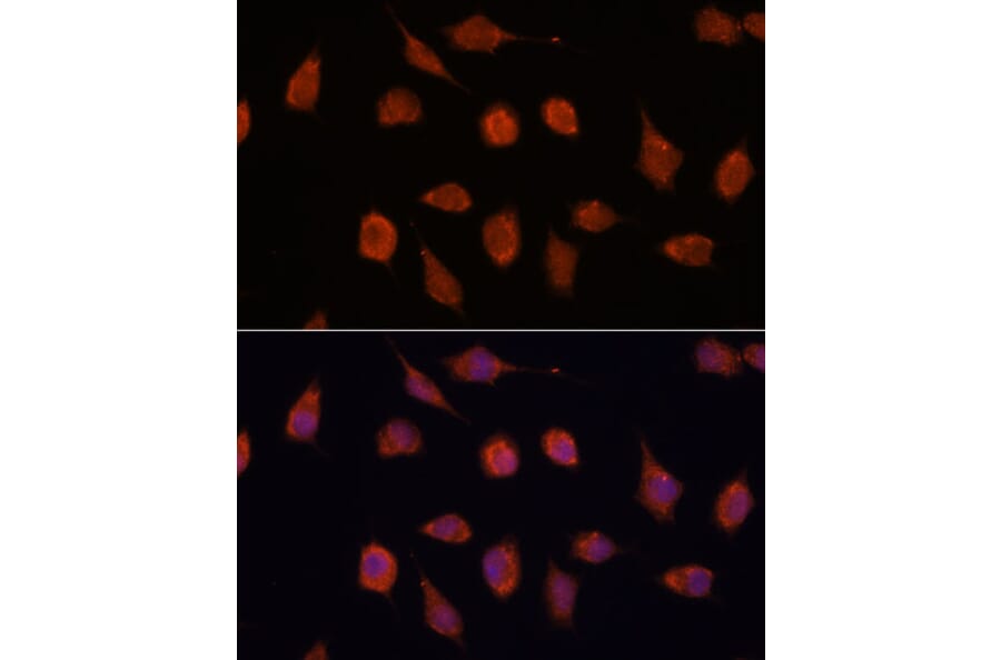 Immunofluorescence - Anti-KCNAB2 Antibody (A90027) - Antibodies.com