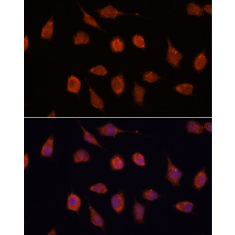 Immunofluorescence - Anti-KCNAB2 Antibody (A90027) - Antibodies.com