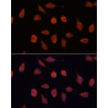 Immunofluorescence - Anti-KCNAB2 Antibody (A90027) - Antibodies.com