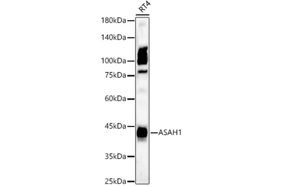 Western Blot - Anti-ASAH1 Antibody (A90028) - Antibodies.com