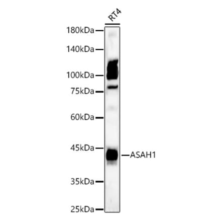 Western Blot - Anti-ASAH1 Antibody (A90028) - Antibodies.com