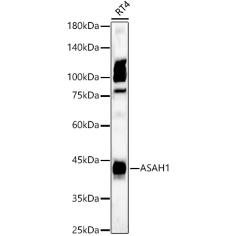 Western Blot - Anti-ASAH1 Antibody (A90028) - Antibodies.com