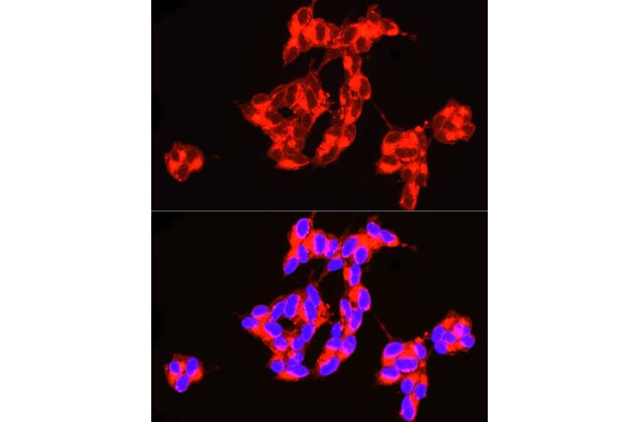 Immunofluorescence - Anti-ASAH1 Antibody (A90028) - Antibodies.com