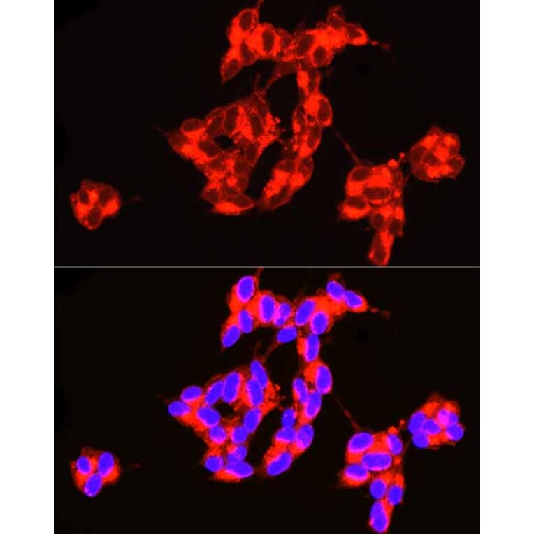 Immunofluorescence - Anti-ASAH1 Antibody (A90028) - Antibodies.com