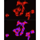 Immunofluorescence - Anti-ASAH1 Antibody (A90028) - Antibodies.com