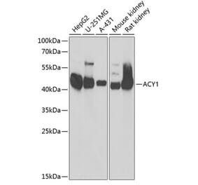 Western Blot - Anti-ACY-1 Antibody (A90029) - Antibodies.com