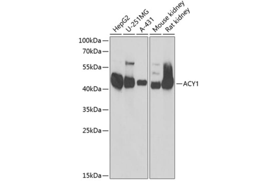 Western Blot - Anti-ACY-1 Antibody (A90029) - Antibodies.com