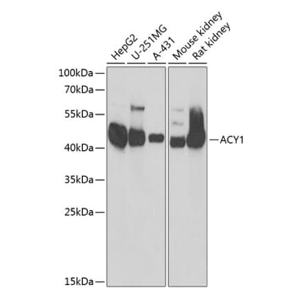 Western Blot - Anti-ACY-1 Antibody (A90029) - Antibodies.com