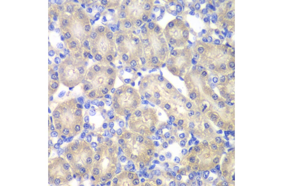 Immunohistochemistry - Anti-ACY-1 Antibody (A90029) - Antibodies.com