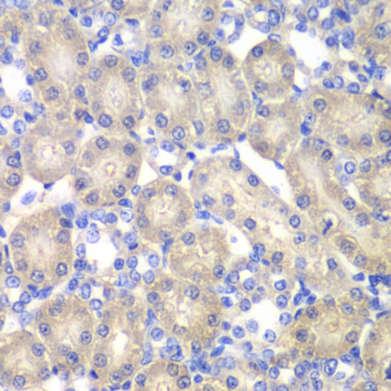 Immunohistochemistry - Anti-ACY-1 Antibody (A90029) - Antibodies.com