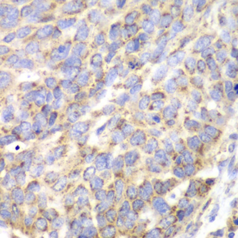 Immunohistochemistry - Anti-ACY-1 Antibody (A90029) - Antibodies.com