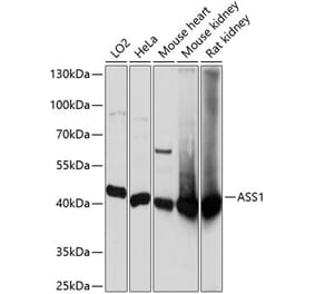 Western Blot - Anti-ASS1 Antibody (A90030) - Antibodies.com