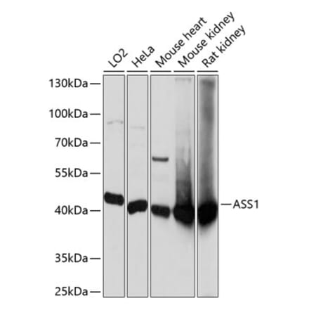 Western Blot - Anti-ASS1 Antibody (A90030) - Antibodies.com