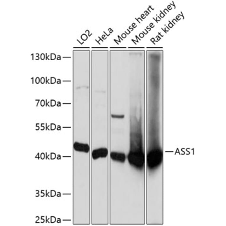 Western Blot - Anti-ASS1 Antibody (A90030) - Antibodies.com