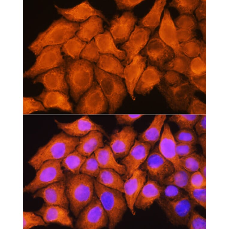 Immunofluorescence - Anti-ASS1 Antibody (A90030) - Antibodies.com