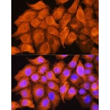 Immunofluorescence - Anti-ASS1 Antibody (A90030) - Antibodies.com