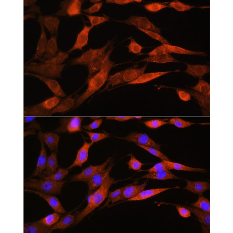 Immunofluorescence - Anti-ASS1 Antibody (A90030) - Antibodies.com