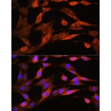 Immunofluorescence - Anti-ASS1 Antibody (A90030) - Antibodies.com