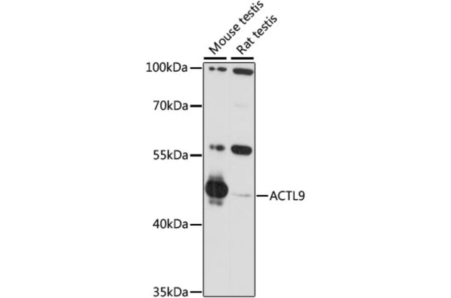 Western Blot - Anti-ACTL9 Antibody (A90031) - Antibodies.com