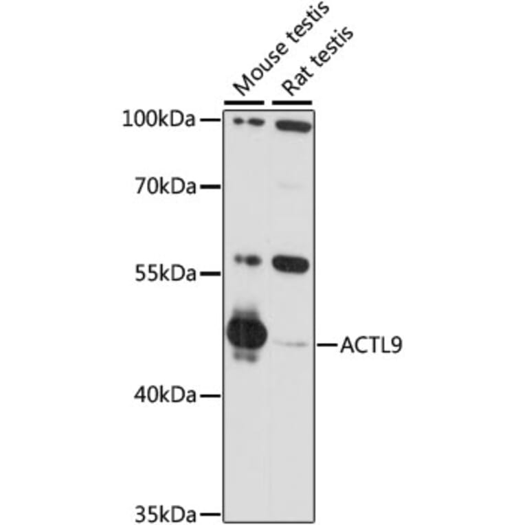 Western Blot - Anti-ACTL9 Antibody (A90031) - Antibodies.com