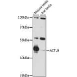 Western Blot - Anti-ACTL9 Antibody (A90031) - Antibodies.com