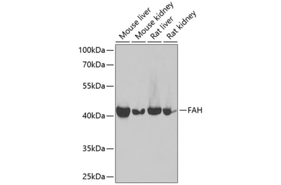 Western Blot - Anti-Fumarylacetoacetate hydrolase/FAA Antibody (A90032) - Antibodies.com