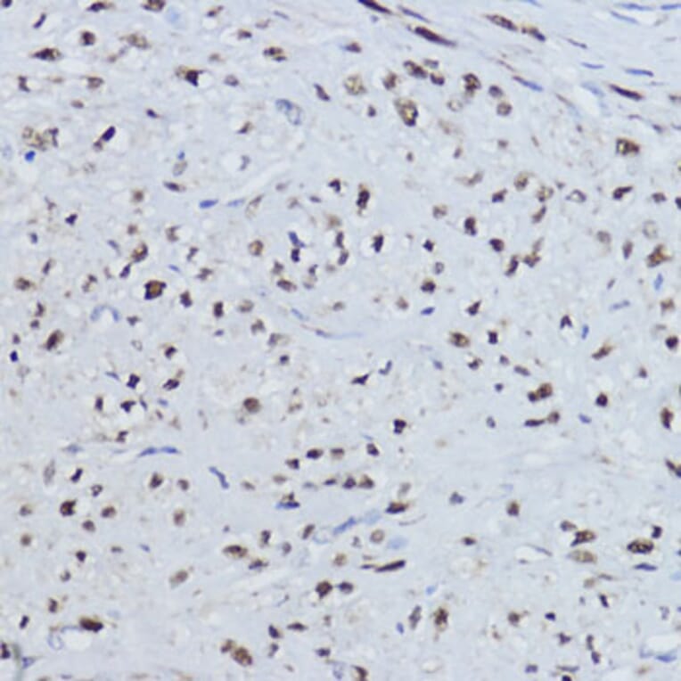Immunohistochemistry - Anti-Estrogen Related Receptor alpha Antibody (A90033) - Antibodies.com